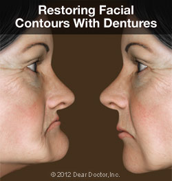 denture-faces-thumb